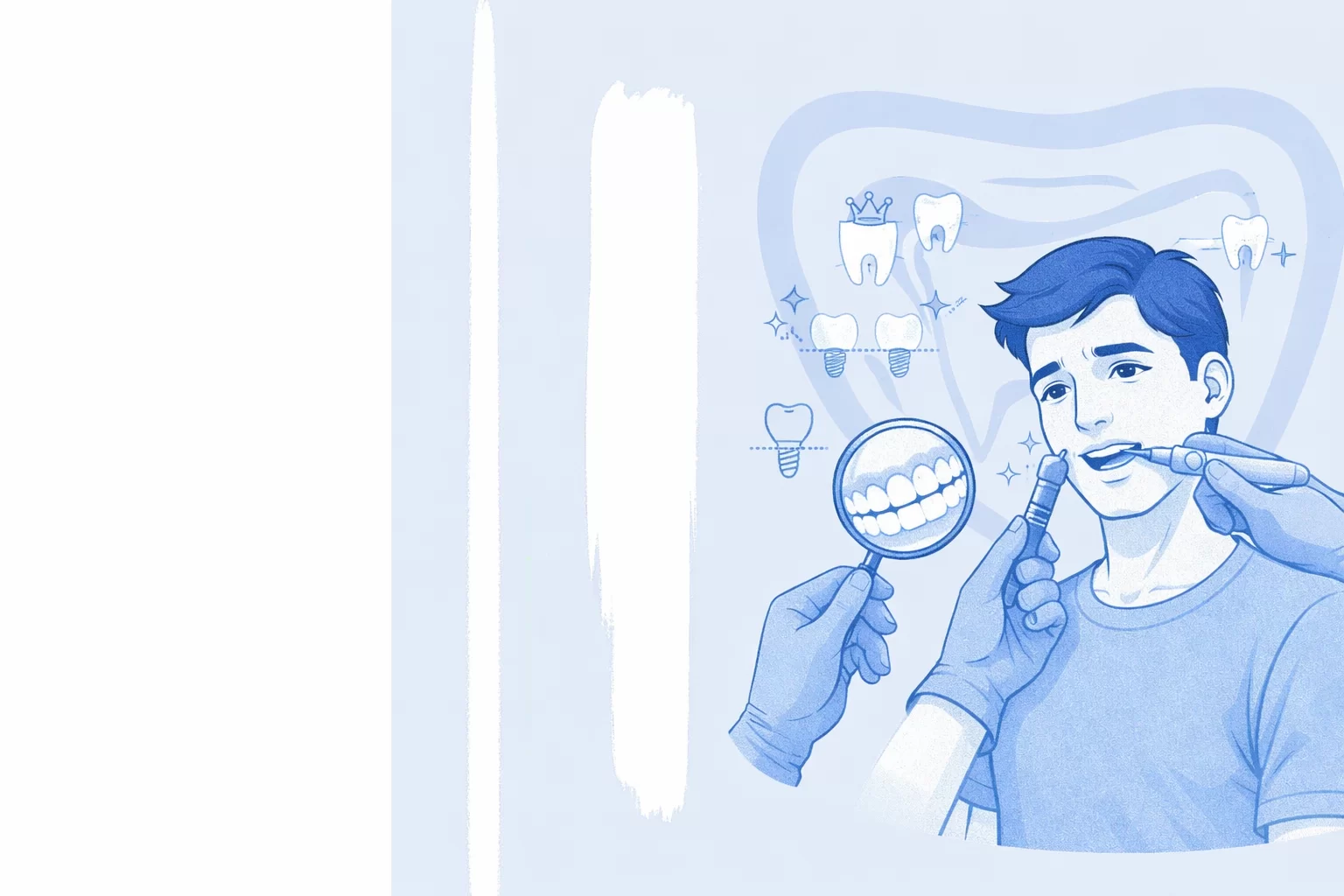 What Is Smile Rehabilitation? A Comprehensive Full-Mouth Restoration Process